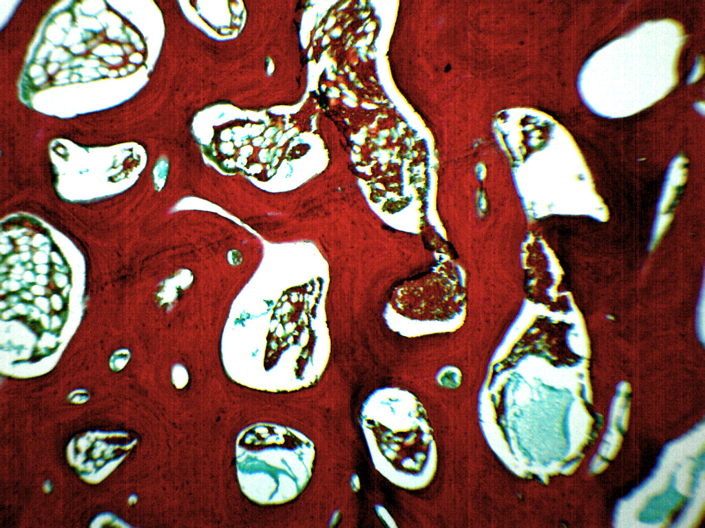 Spongy Bone (Mammal) Prepared Microscope Slide