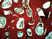 Spongy Bone (Mammal) Prepared Microscope Slide