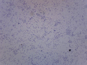 Clostridium Botulinum Gram Positive Prepared Microscope Slide