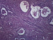 Human Prostate Section with GS Stain Prepared Microscope Slide