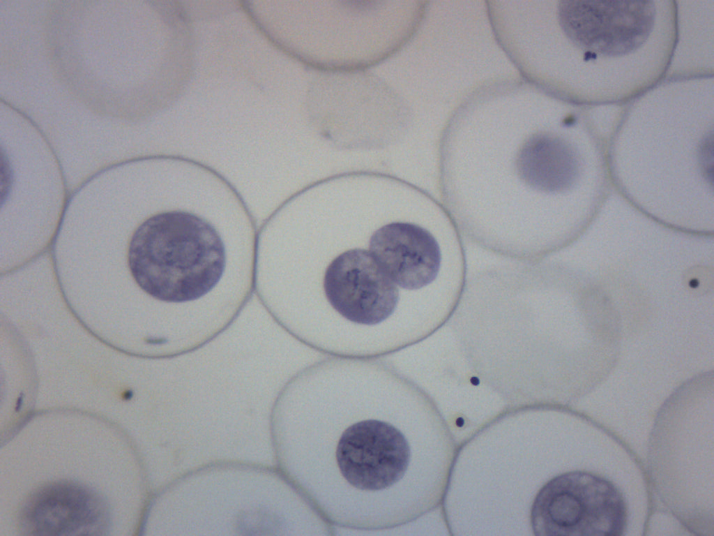 Ascaris and Onion Mitosis Prepared Microscope Slide