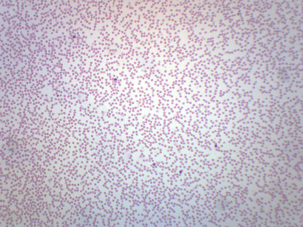 Human Blood Smear Prepared Microscope Slide, WR Stain