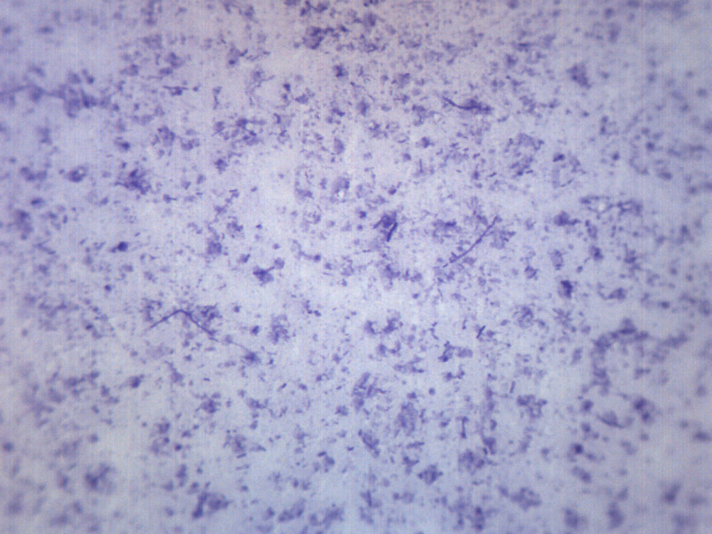 Bacillus Culture Gram Positive and Negative Prepared Microscope Slide