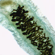 Fasciola Hepatica (Liver Fluke) Prepared Microscope Slide