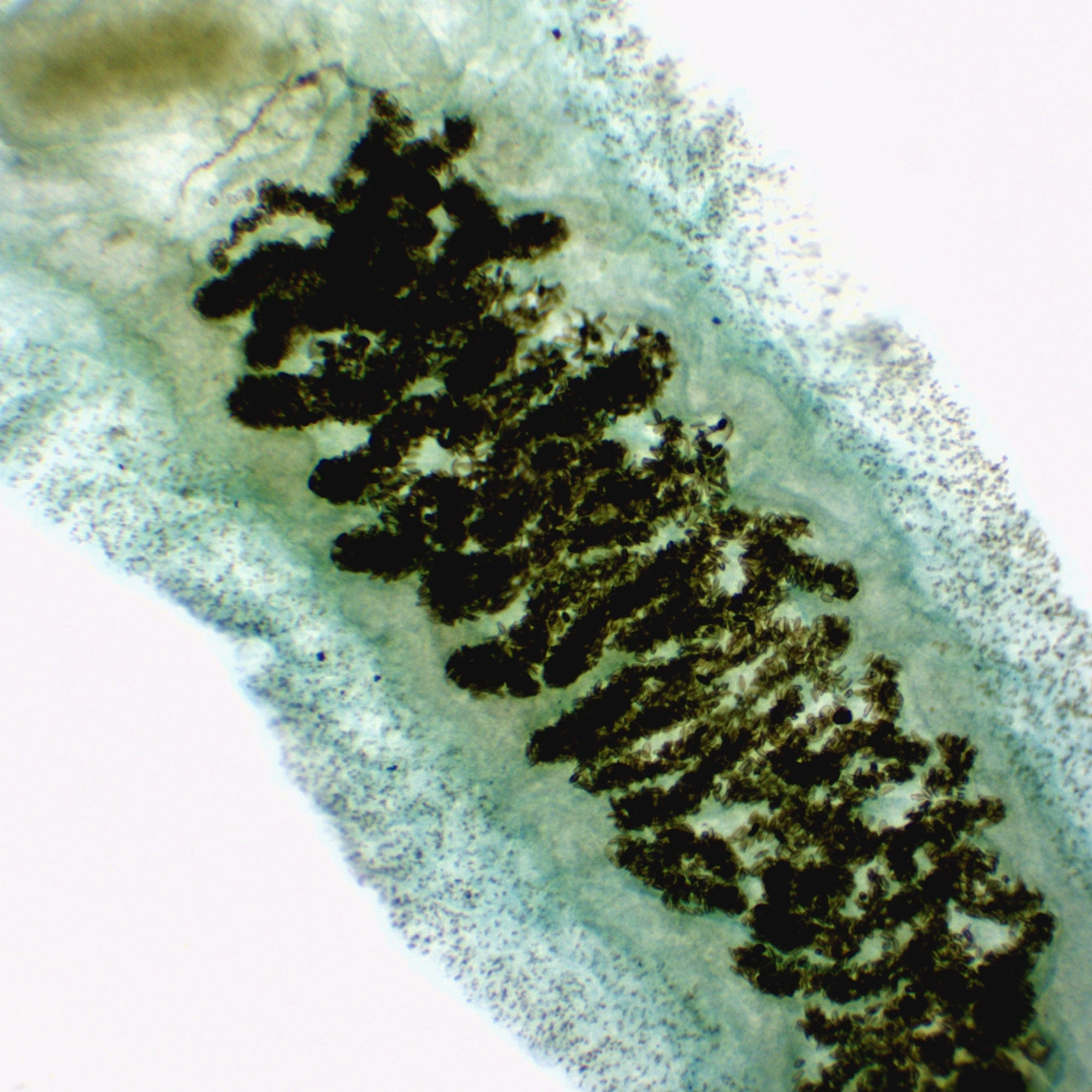 Fasciola Hepatica (Liver Fluke) Prepared Microscope Slide