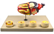 Human Heart Conditions Pathology Model with Artery Cross-Sections, 10"