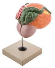 Urinary Bladder with Prostate Anatomical Model, 3X Life Size, 2-Part, 8 x 8 x 6"