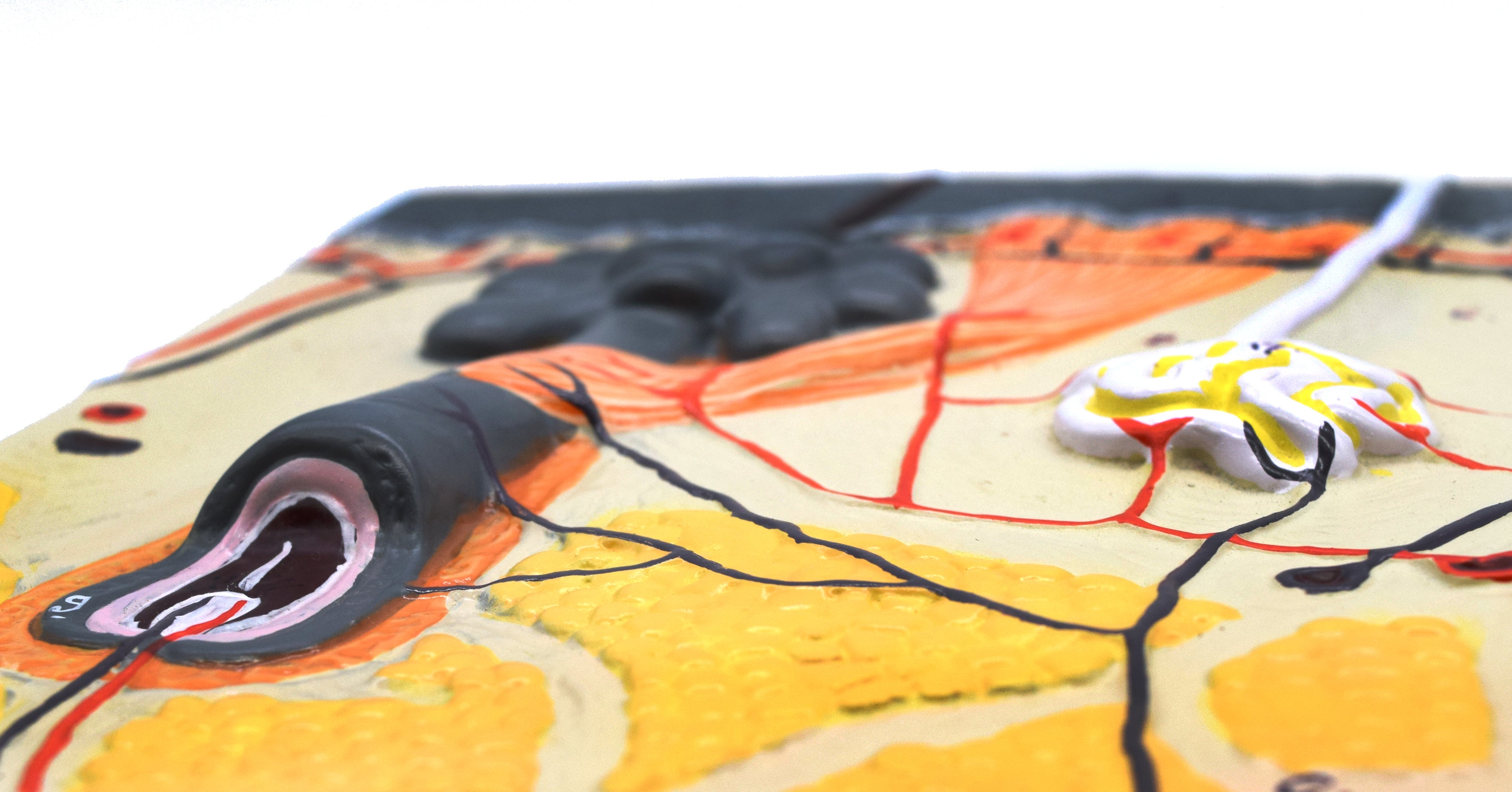 Human Skin Model, 70X Enlarged, 13 x 9"