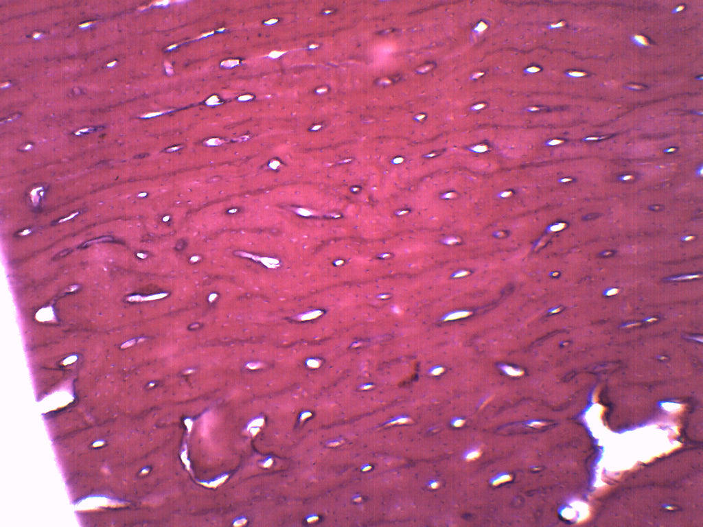 Bone Cross and Longitudinal Section Prepared Microscope Slide