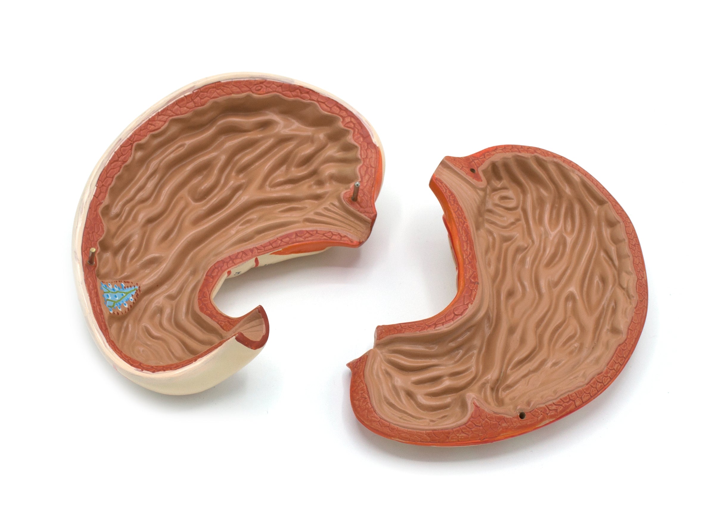 Human Stomach Bisection Model, Life Size