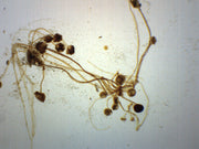 Rhizopus Sporangia Wholemount Prepared Microscope Slide
