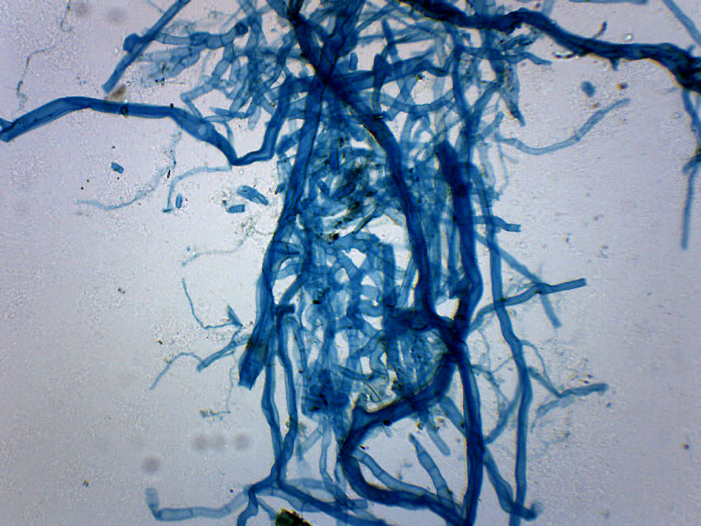 Moss Protonema Wholemount Prepared Microscope Slide
