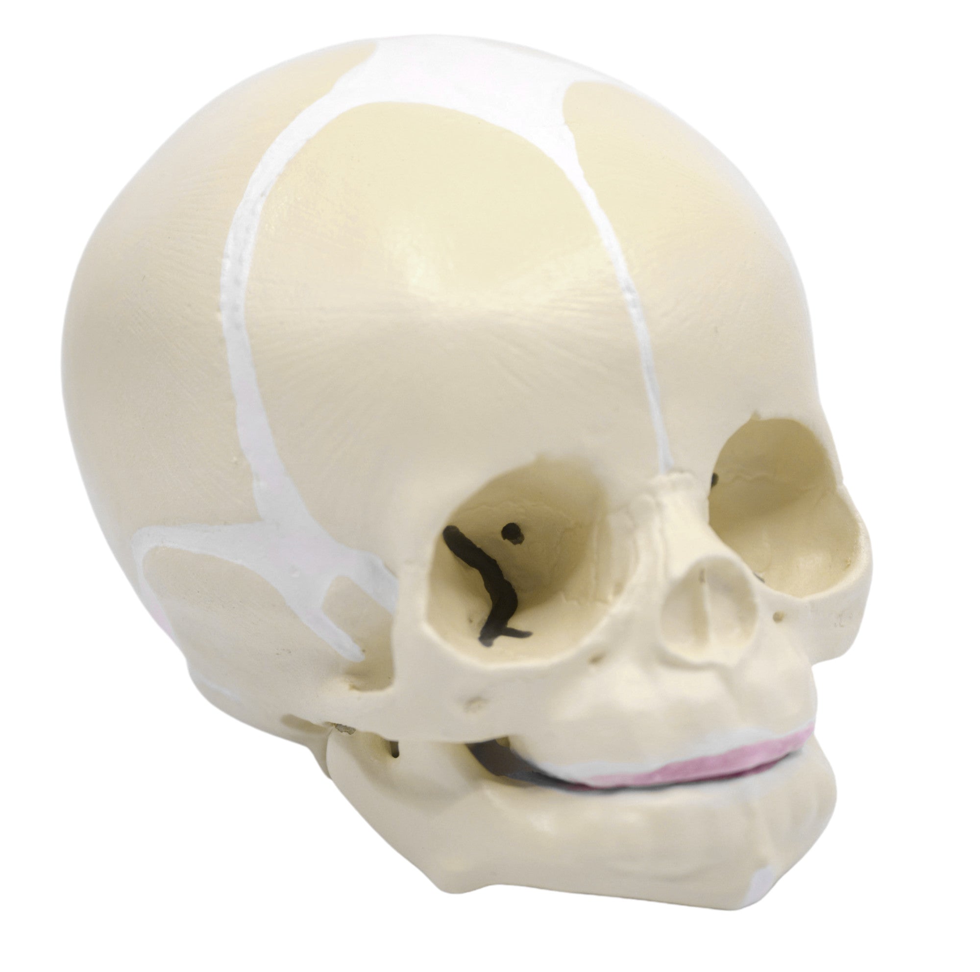 Infant Skull Anatomical Model with Articulated Mandible, Life Size