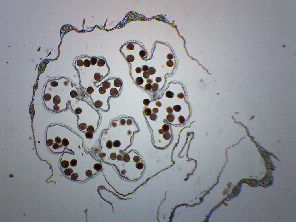 Monocot and Dicot Flower Bud Prepared Microscope Slide