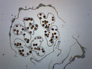 Monocot and Dicot Flower Bud Prepared Microscope Slide