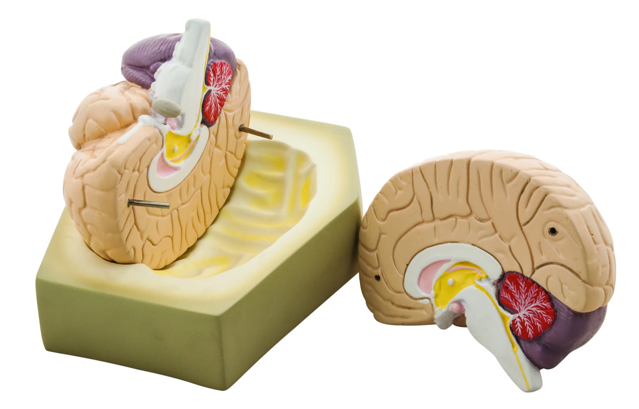 Detailed 2-Part Human Brain Model, 6.5 x 6.5"